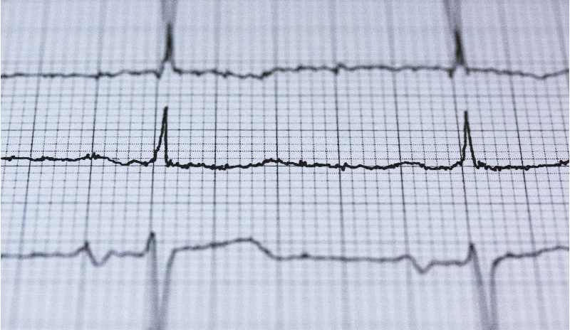 Procurement Health Check